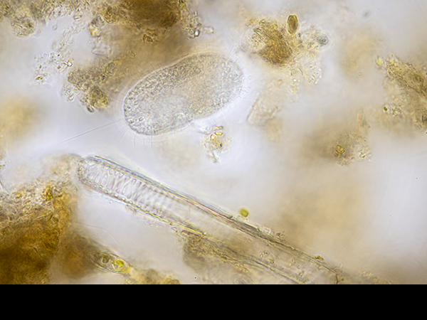 Marsh sample, Paramecium