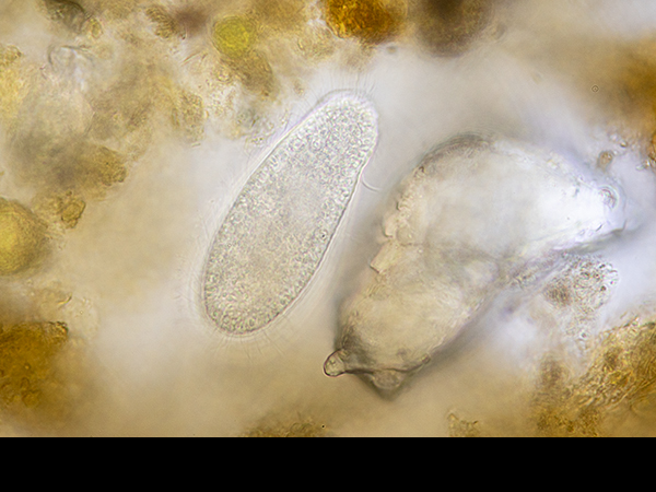 Marsh sample, Paramecium