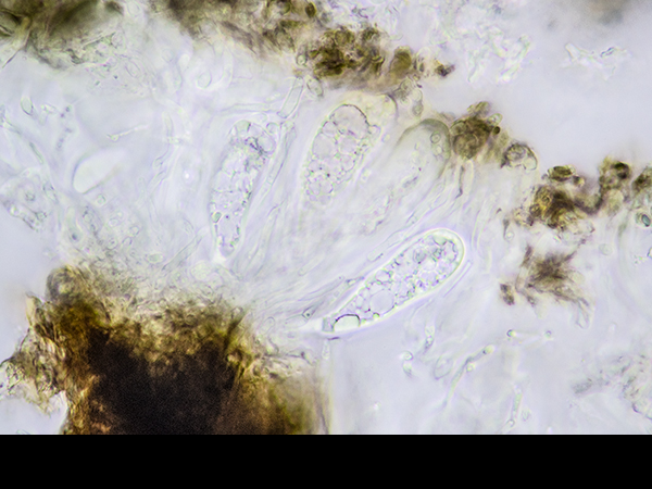 Lecidea lithophila, asci with spores