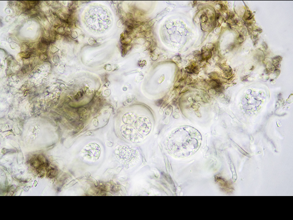 Lecidea lithophila, asci with spores