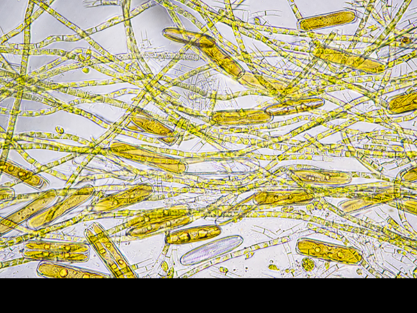 Pinnularia spp., Diatom