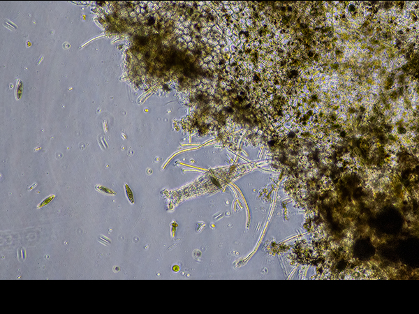 Bdelloid rotifer