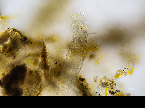 Bdelloid rotifer