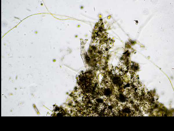 Bdelloid rotifer