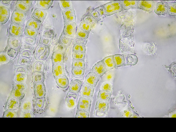 Ulothrix, Green filamentous algae