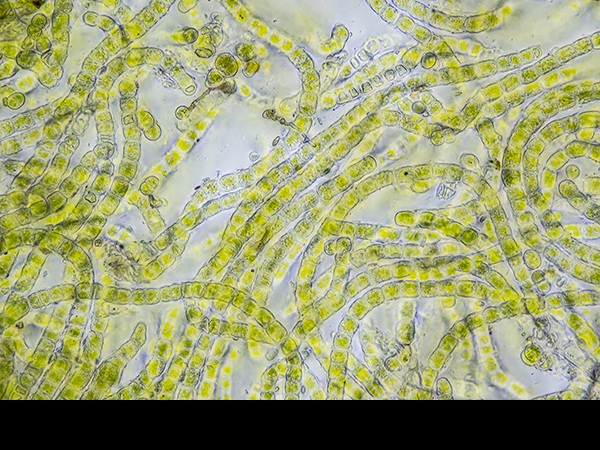 Ulothrix, Green filamentous algae